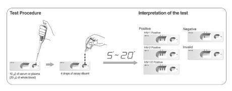hiv抗体检测试剂盒(胶体金法)